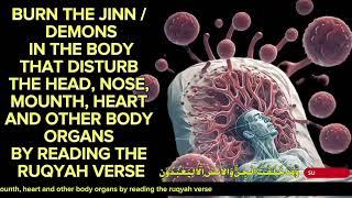 BURNING THE JINN/DEMONS WITHIN THE BODY THAT DISTURB THE ORGANS BY RECITING RUQYAH VERSES