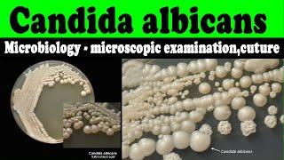 Candida albicans microbiology - microscopic examination,cuture(laboratory diagnosis)