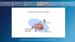 Key screening views of the fetal heart - Part 4 - Left ventricular outflow