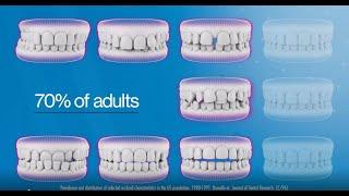 Get Your Oral Health Straight with Invisalign Treatment
