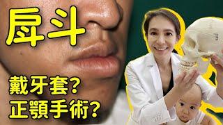 戽斗戴牙套矯正能改善臉型？還是一定要正顎手術？｜林榆芩醫師