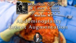 Abdominoplasty+Breast Augmentation - Cosmetic Surgery and Laser Center of El Paso | Dr. Mark Jabor