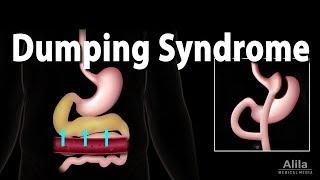 Dumping Syndrome, Animation