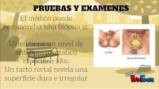 cancer de prostata