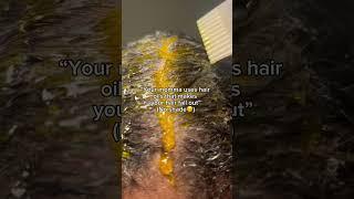 African+Indian oil are the BEST combo for FAST hair growth#hair #hairgrowth #naturalhair #haircare