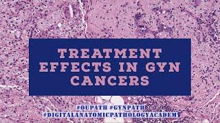 Treatment Effects in Gyn Cancers