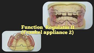 Functional regulator 2 production process / Frankel appliance II /Orthodontics