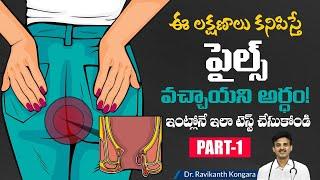 Causes of Piles | How to Treat Piles Part1 | Fistula | Fissures | Dr. Ravikanth Kongara