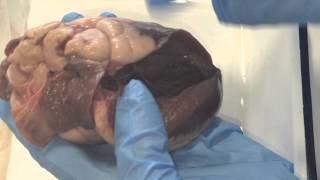 CHANTE HEARST heart dissection