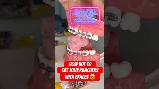 How NOT to eat JOLLY RANCHERS with BRACES  #braces #candy #crunchy
