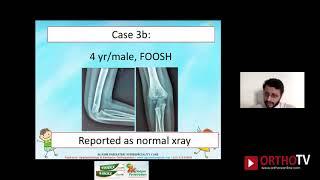 OrthoTV Original - Skeletal Xrays in Pediatric Orthopaedics - Dr Mandar Agashe