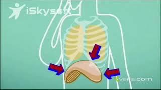 How Hiccups are caused