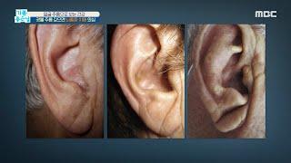 [HEALTHY] Deep earlobes, deep wrinkles, suspect stroke or dementia!, 기분 좋은 날 20200925