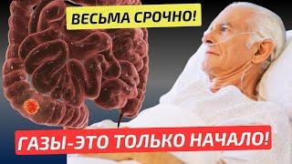 Замучали ГАЗЫ и ВЗДУТИЕ! Жаль не знал раньше об ЭТОМ! Метеоризм - причины, последствия и лечение.