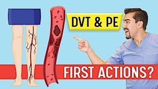 DVT Animation   Deep Vein Thrombosis and Pulmonary Embolism PE   Memory Tricks for Exams NCLEX