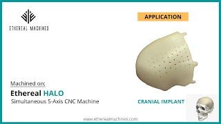 Custom made Cranial Implant - 5 axis CNC Machining (Ethereal HALO - Simultaneous 5-axis CNC)