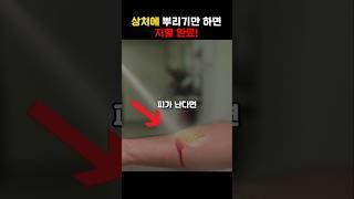 상처에 뿌리기만 하면 지혈 완료!