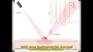 Phansco Raman tech for Skin Care 2025 05 21 02