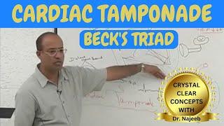 Cardiac Tamponade | Beck's Triad | Cardiology🫀