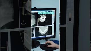 MAXILLOFACIAL - MEDICAL DEFINITION | Medical Consecutive Interpreting