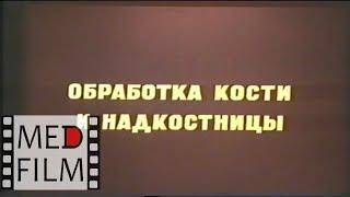 Ампутация: обработка кости, надкостницы, сосудов, нервов, мышц, фасций, создание культи © Amputation