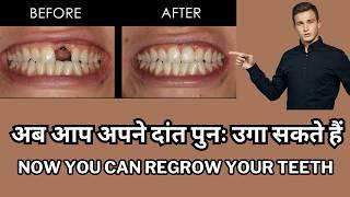 You Can Regrow Teeth Now?! |World's First Tooth-Growing Drug Explained  #toothregrowthresolution