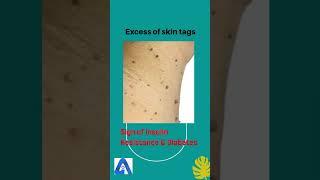 5 Skin Issues That Could Indicate Underlying Health Problems | Aiconic Health