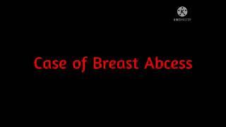 Breast abcess case on ultrasound or sonography.