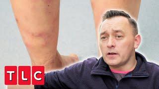 Dr Emma Helps Man In Agony From Painful STABBING Sores | Bad Skin Clinic