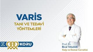 Varis Tanı ve Tedavi Yöntemleri