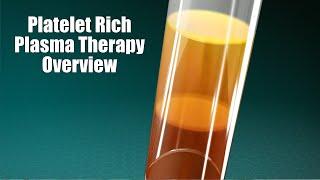 Platelet rich plasma therapy explained