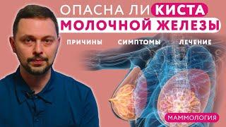  Киста молочной железы: причины, диагностика, симптомы и лечение // #клиникащербатовой #мастопатия