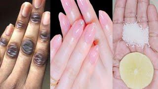 Permanent hand whitening secrets | Hand whitening secrets at home | Hand whitening secrets