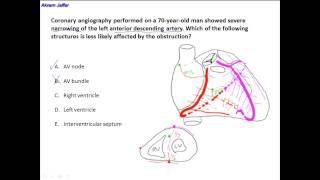 Anatomy of the left anterior descending artery