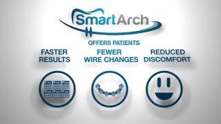 Smarter Alloys Smartarch