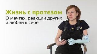 Жизнь с протезом — о мечтах, реакции других и любви к себе