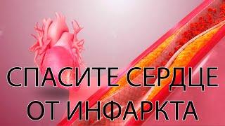 Главное упражнение при стенокардии напряжения - мини-курс