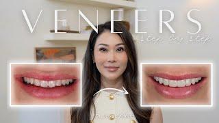 The Entire Veneers Process - Everything You Need to Know with Dr. Joyce Kahng