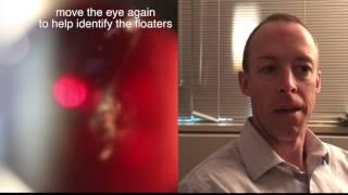 Laser Floater Removal (vitreolysis) patient procedure and testimonial by Dr. Paul Singh