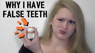 MY DENTURES | Bethany Wilhelm