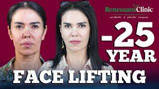 FACE LIFTING -25 YEAR  ПОДТЯЖКА ЛИЦА -25 ЛЕТ  YUZ TORTTIRISH -25 YOSH