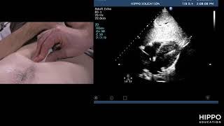 Hippo Education Urgent Care Bootcamp Ultrasound CardiacSC