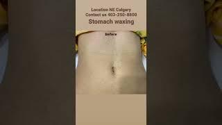 Stomach waxing please like,subscribe, share & comments#shorts #ytshorts #stomach #waxing #wax