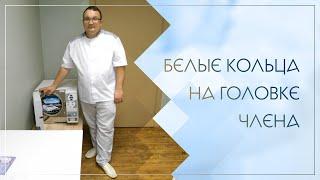  Белые кольца на головке члена. Клинический случай №91