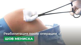 Реабилитация после операции "шов мениска"