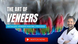 Making Porcelain Veneers | The Art of Veneers