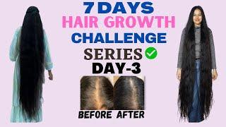 Day-3 HAIR GROWTH challenge series|Grow your hair long |#pooja mehra#hairgrowth #hairgrowthchallange