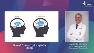 Understanding Normal Pressure Hydrocephalus with Dr. Arjun Srivatsa | Sakra World Hospital