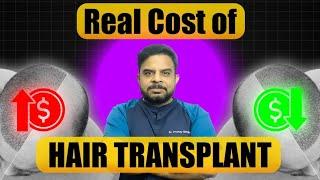 Real Cost of Hair Transplant 