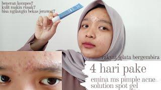 REVIEW JUJUR EMINA MS PIMPLE ACNE SOLUTION SPOT GEL SETELAH 4 HARI PAKAI I FACA